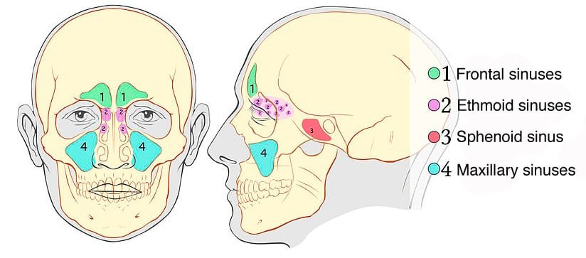 sinusitis