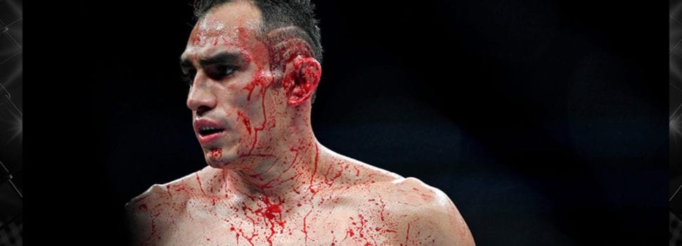 Tony ‘El Cucuy’ Ferguson, el gran ganador de UFC 229