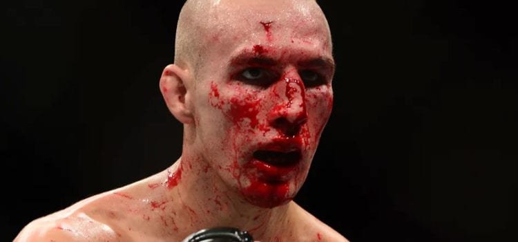 Rory MacDonald asegura sí estar concentrado en su pelea esta vez
