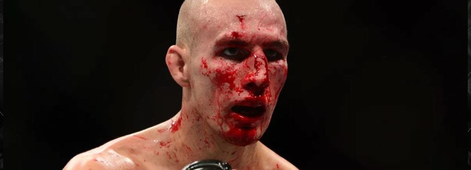 Rory MacDonald asegura sí estar concentrado en su pelea esta vez