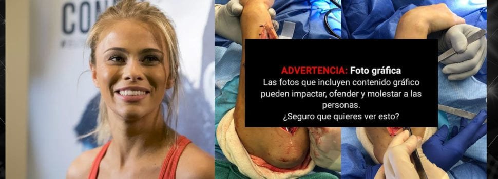VanZant comparte terribles imágenes de su brazo tras la última cirugía