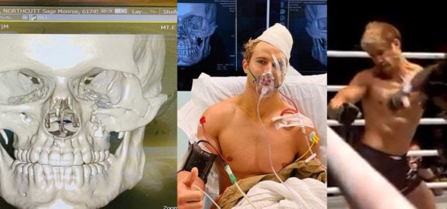 Sage Northcutt comparte imágenes de sus ocho fracturas tras KO