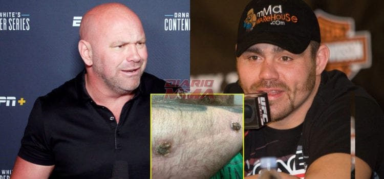 UFC le niega ayuda a ex campeón Tim Sylvia por lesión sufrida en UFC 48